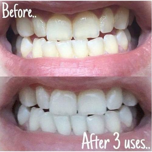 Teeth Whitening Toothpaste ????.
