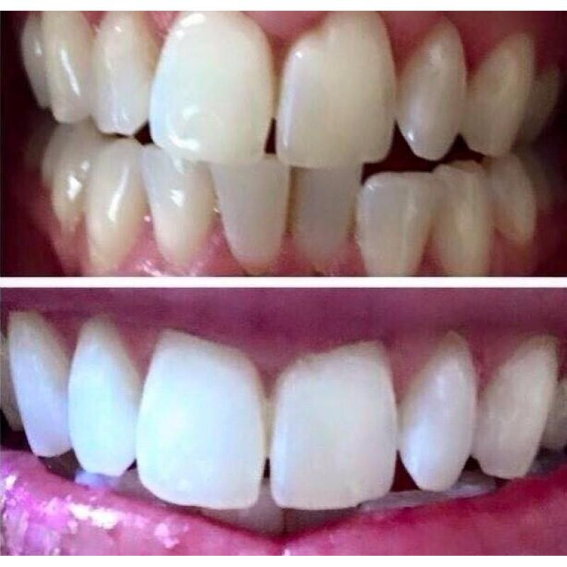 Teeth Whitening Toothpaste ????.